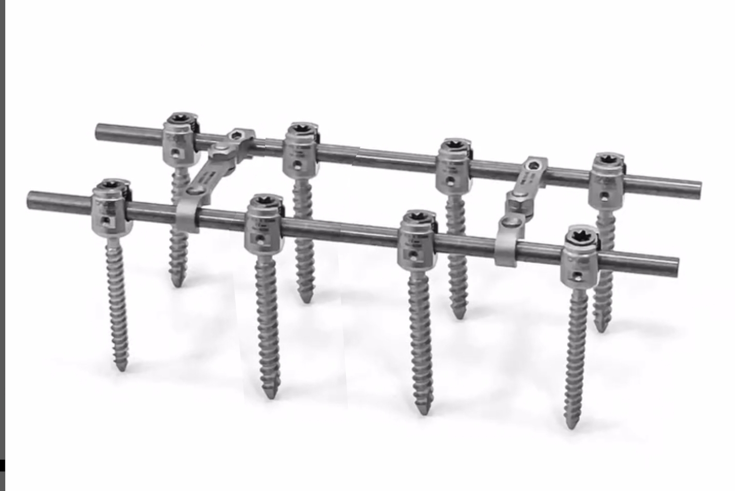 Транспедикулярна конструкція Medical Concept (8 гвинтів)